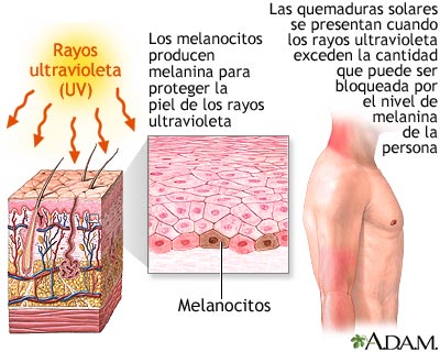 El maquillaje con las pecas la morena